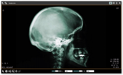 Getting Started with WindowsForms Dicom