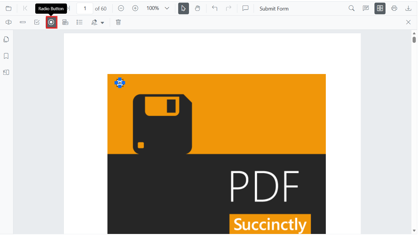 Radio buttons added from UI